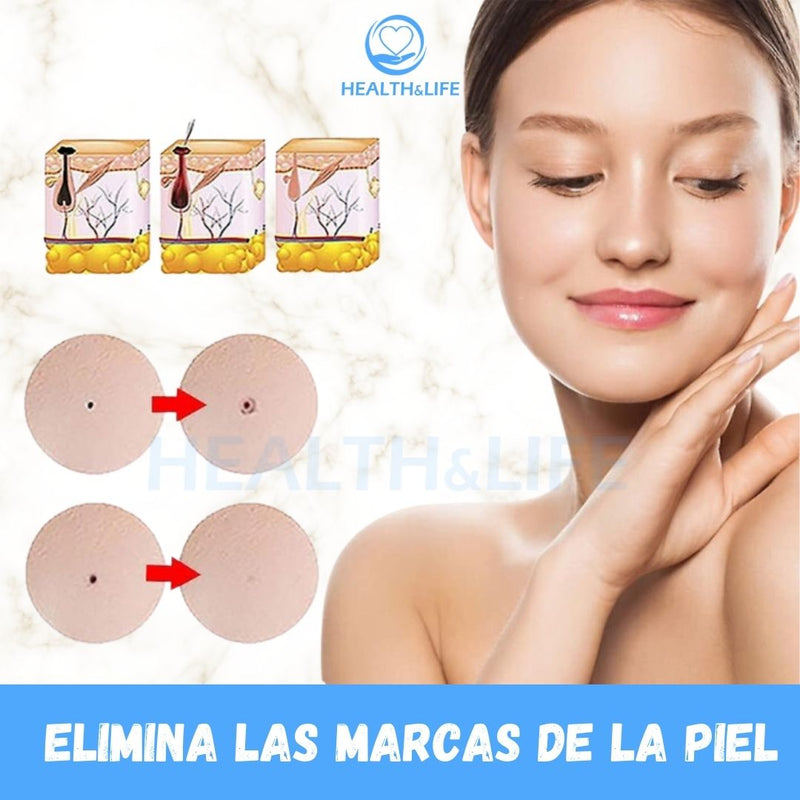 WartRemover™- Crema para la eliminación inmediata de las impurezas de la piel