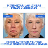 RenovaPiel™- Sérum Anti-Edad con Efecto Botox