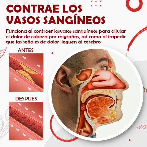 Migcare™- Inhalador Nasal Alivio Migrañas