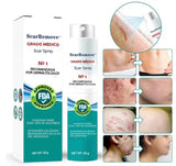 ScarRemove™- Spray Anticicatrices, acné, estrías...⚡️