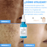 Re Youth Bio™ - Sérum para la eliminación de manchas y acné